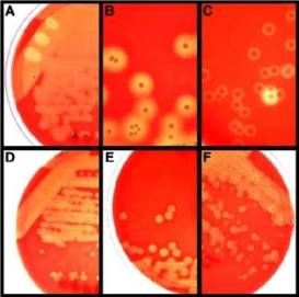 group a beta hemolytic streptococcus