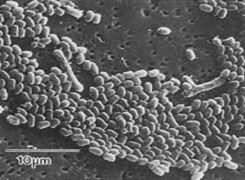 炭疽菌 コロナウィルス ABC兵器 バイオ兵器　生物兵器
